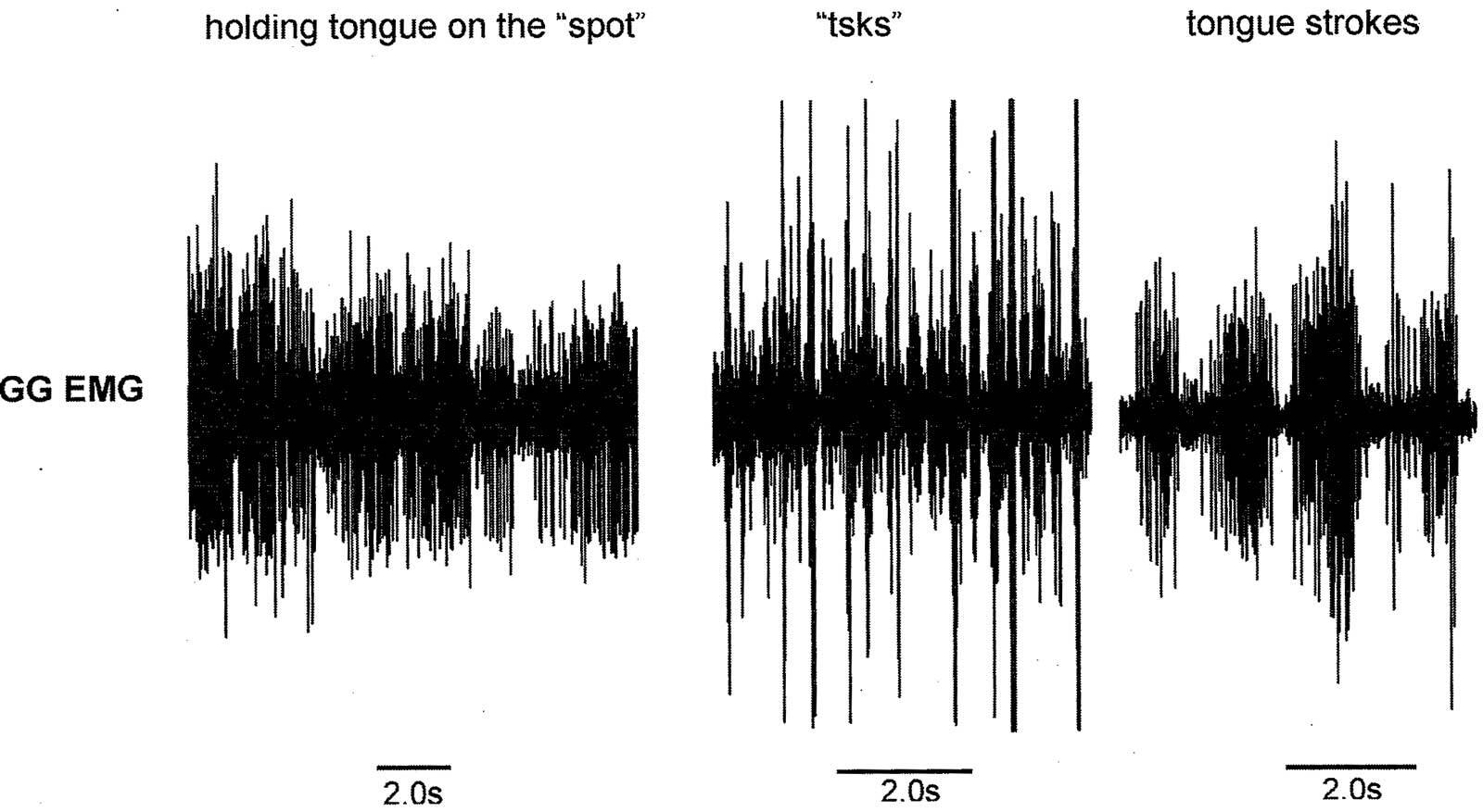 Tongue-Stick-Graph.jpg